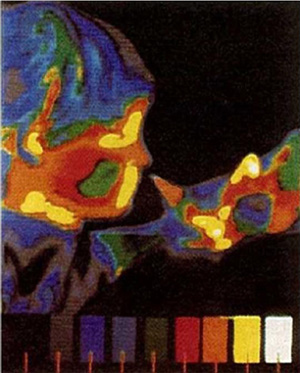 Thermal Image