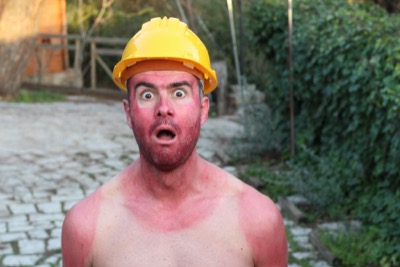 Protecting yourself in the Sun – Part 1